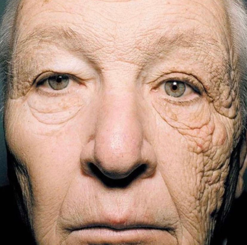 SPF Is Your BFF: Benefits of Wearing Sunscreen - MY SKIN SPOT