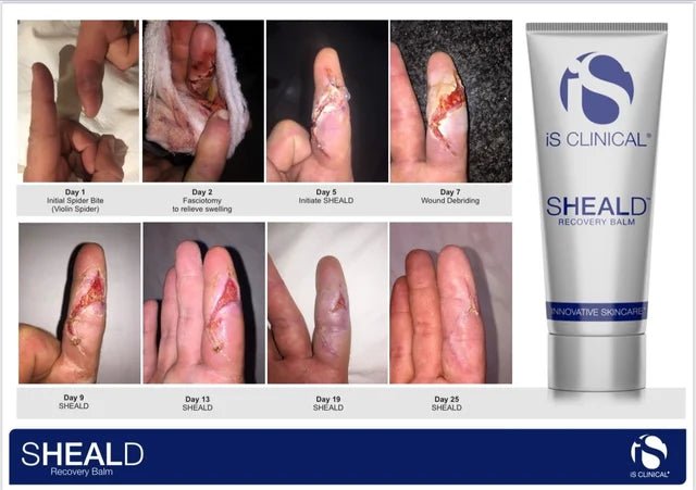 iS CLINICAL Shield Recovery Balm - MY SKIN SPOT