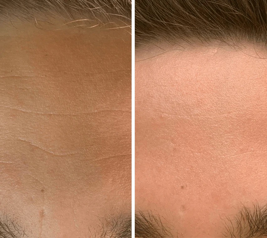 OMNILUX Mens - MY SKIN SPOT