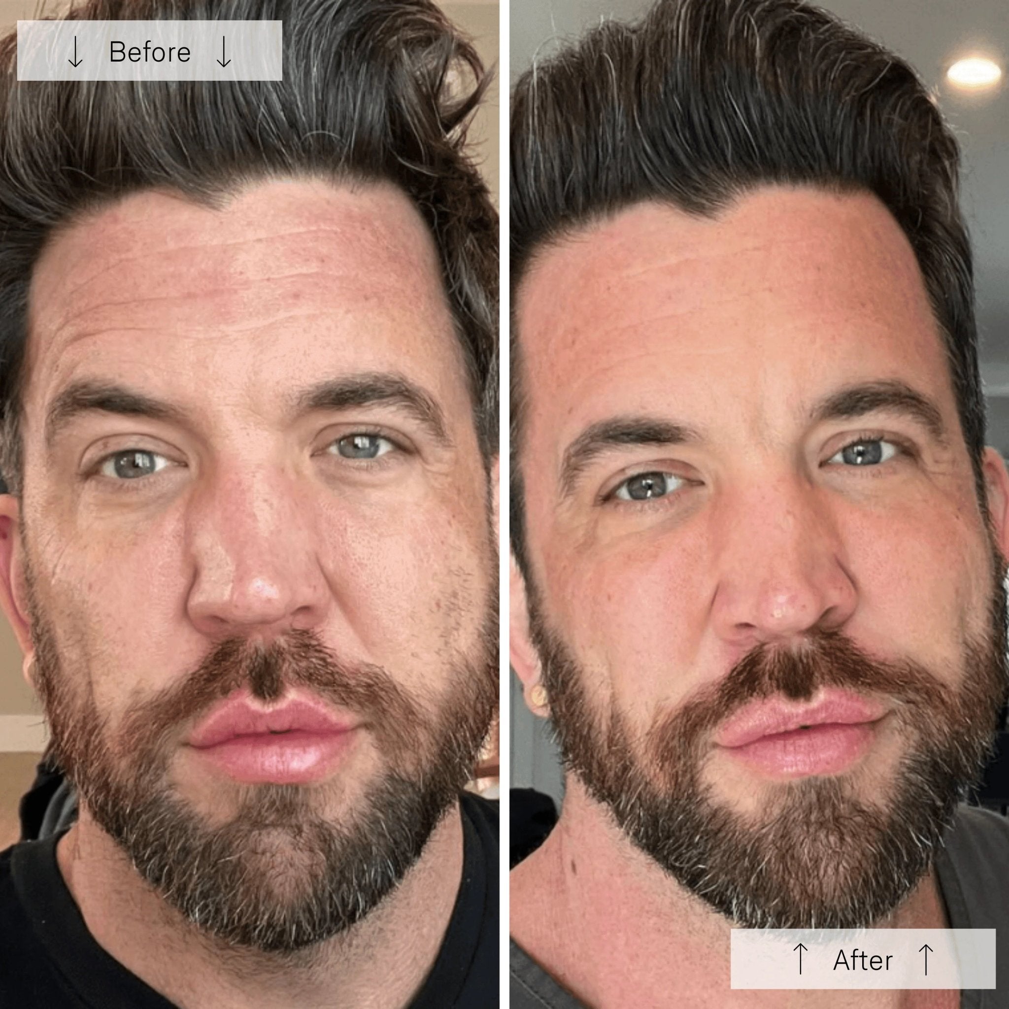 OMNILUX Mens - MY SKIN SPOT