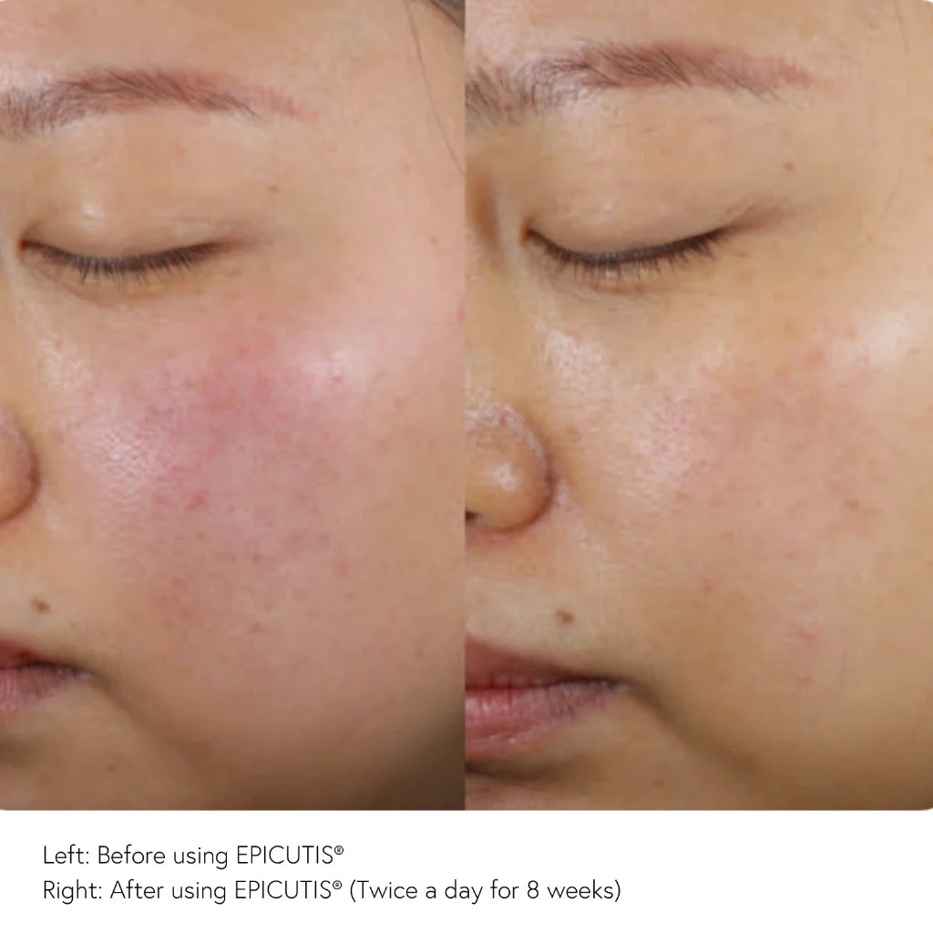 EPICUTIS Arctigenin Brightening Treatment