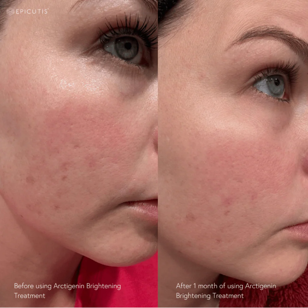EPICUTIS Arctigenin Brightening Treatment
