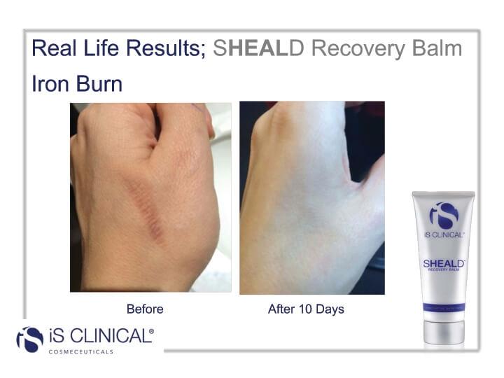 iS CLINICAL SHEALD RECOVERY BALM